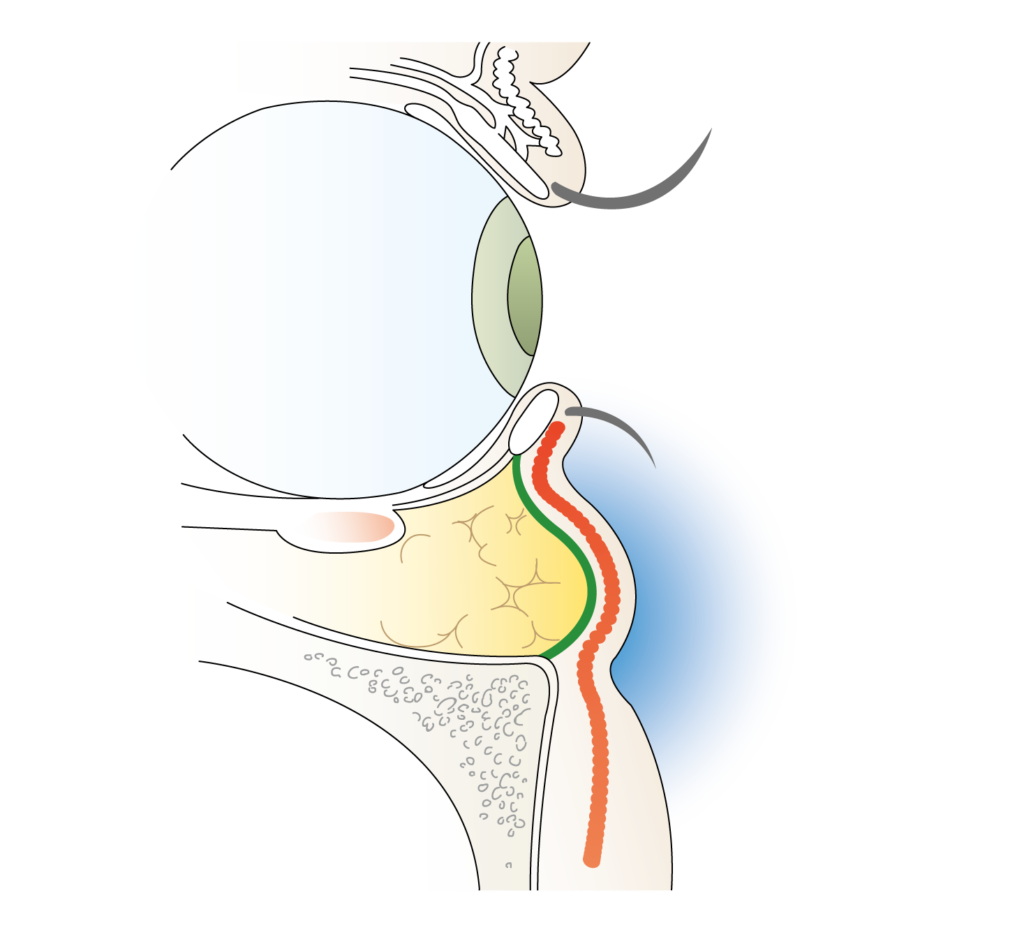 目の下のくまやふくらみ コラム 顔のクリニック金沢 金沢の美容外科 形成外科